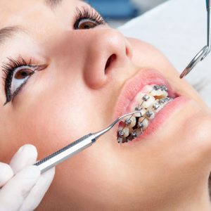 حل مشکلات دندانی با ارتودنسی
