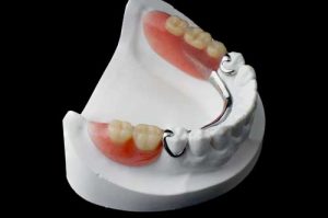 دندان های مصنوعی