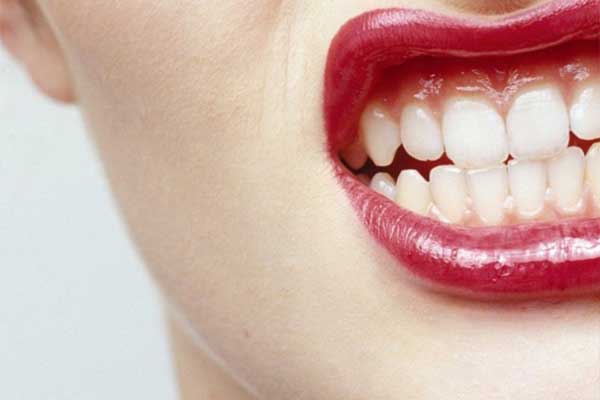 علت دندان قروچه یا بروکسیسم