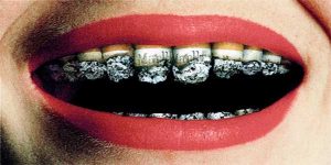 سیگار کشیدن و سلامت دندان ها