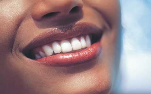 سفید کردن دندان بعد از عصب کشی دندان