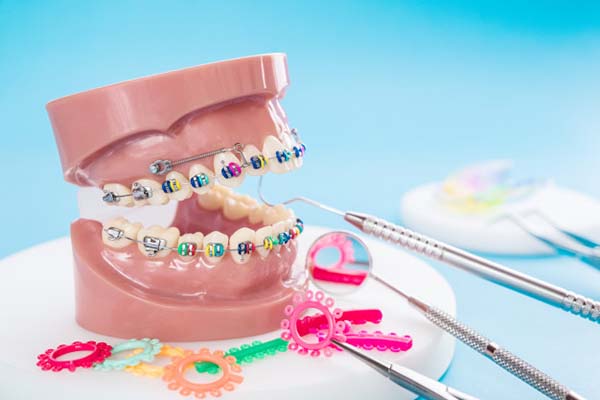 حرکت دندان ها در ارتودنسی دندان ها