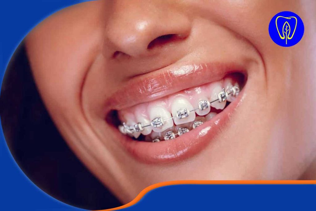 افزایش پایداری نتایج درمان ارتودنسی