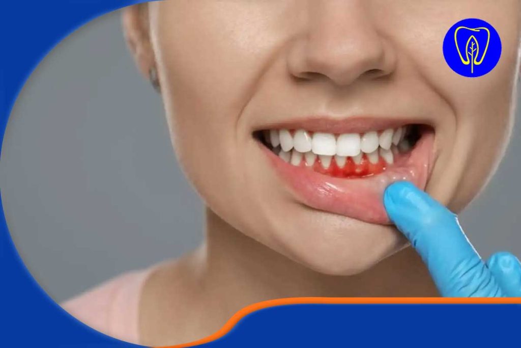 کاهش فشار بر لثه و بافت‌های نگهدارنده دندان