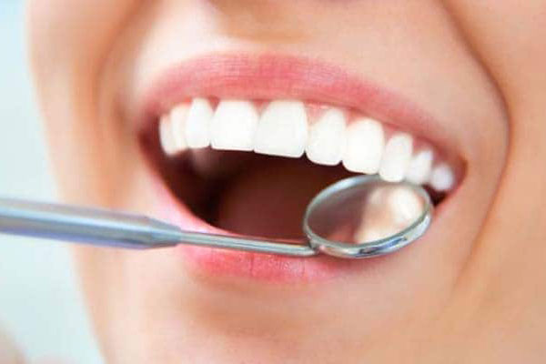 انواع مواد پرکردن دندان