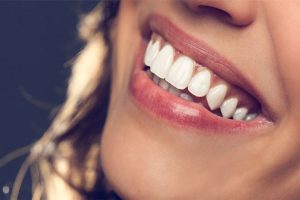 اهمیت مراقبت از لثه ها