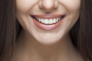 شل شدن روکش ایمپلنت