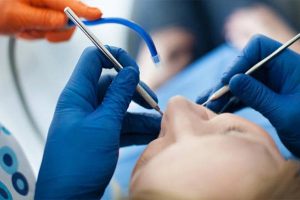 ترمیم دندان عصب کشی شده