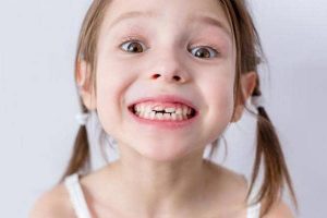 پوسیدگی دندان کودکان