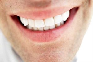 انواع روکش دندان