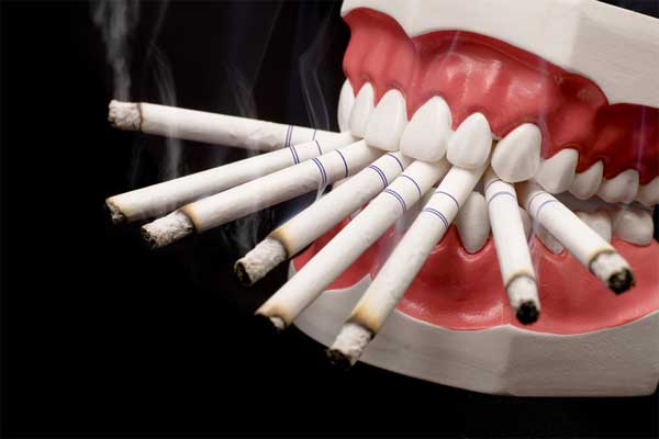 سیگار کشیدن و سلامت دندان ها