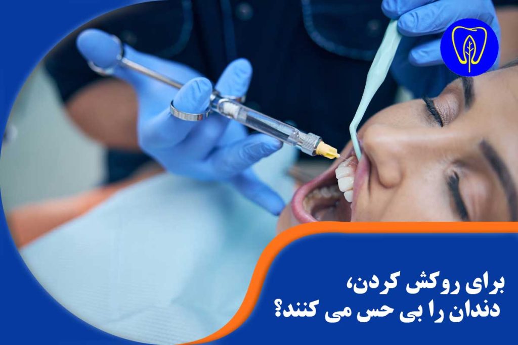 روکش کردن دندان