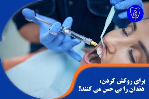 روکش کردن دندان
