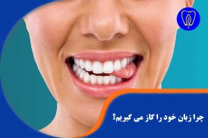 گاز گرفتن زبان