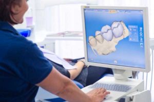 دندانپزشکی CEREC