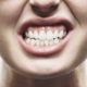 بروکسیسم یا دندان قروچه