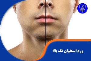 ورم استخوان فک بالا