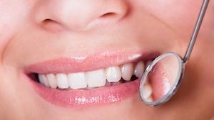 روش های دندانپزشکی زیبایی