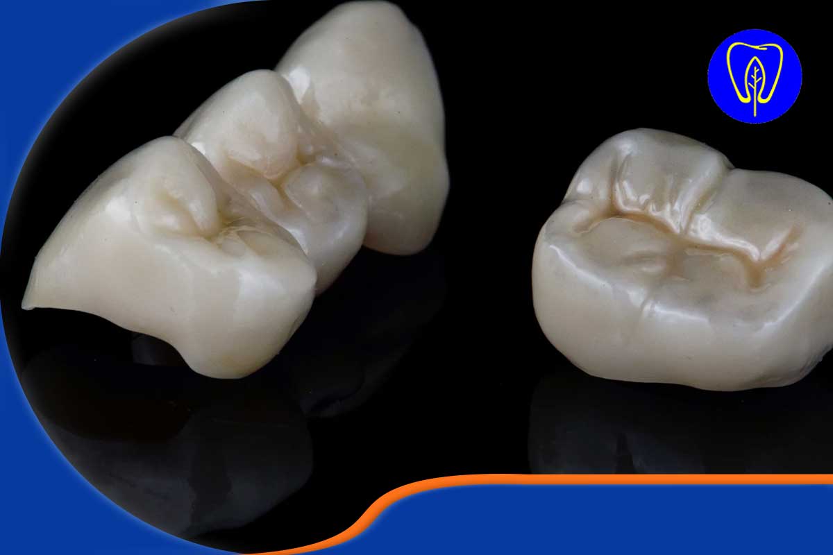 آناتومی دندان و دلیل علمی نیاز به بیحسی در تراش روکش