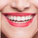 طراحی لبخند | سخت شدن مینای دندان