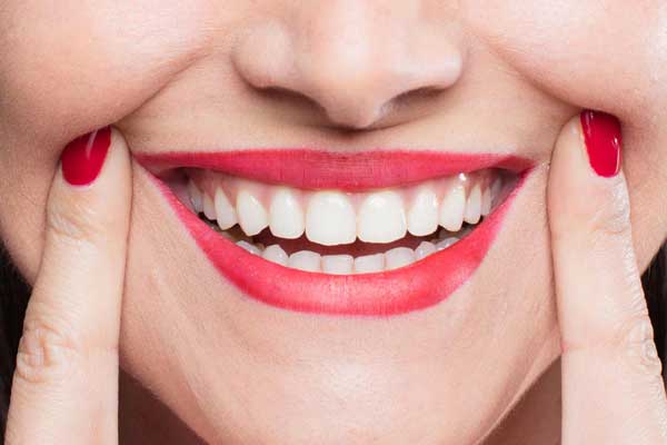 طراحی لبخند | سخت شدن مینای دندان