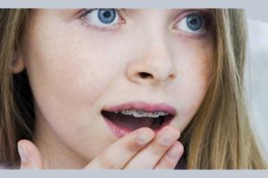 مال اکلوژن چیست