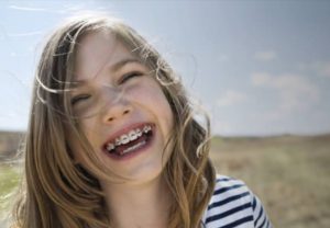 ارتودنسی فانکشنال