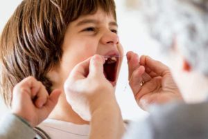 لق شدن دندان شیری