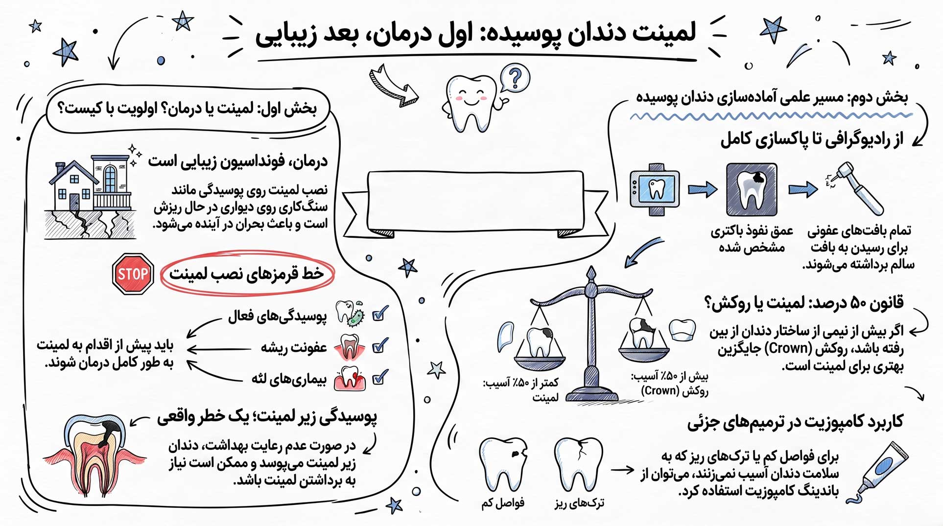آیا با وجود پوسیدگی دندان میتوان لمینت کرد؟