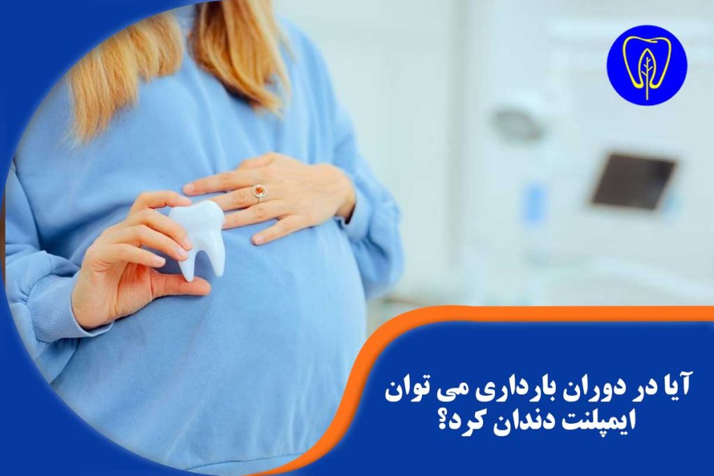 ایمپلنت دندان در دوران بارداری