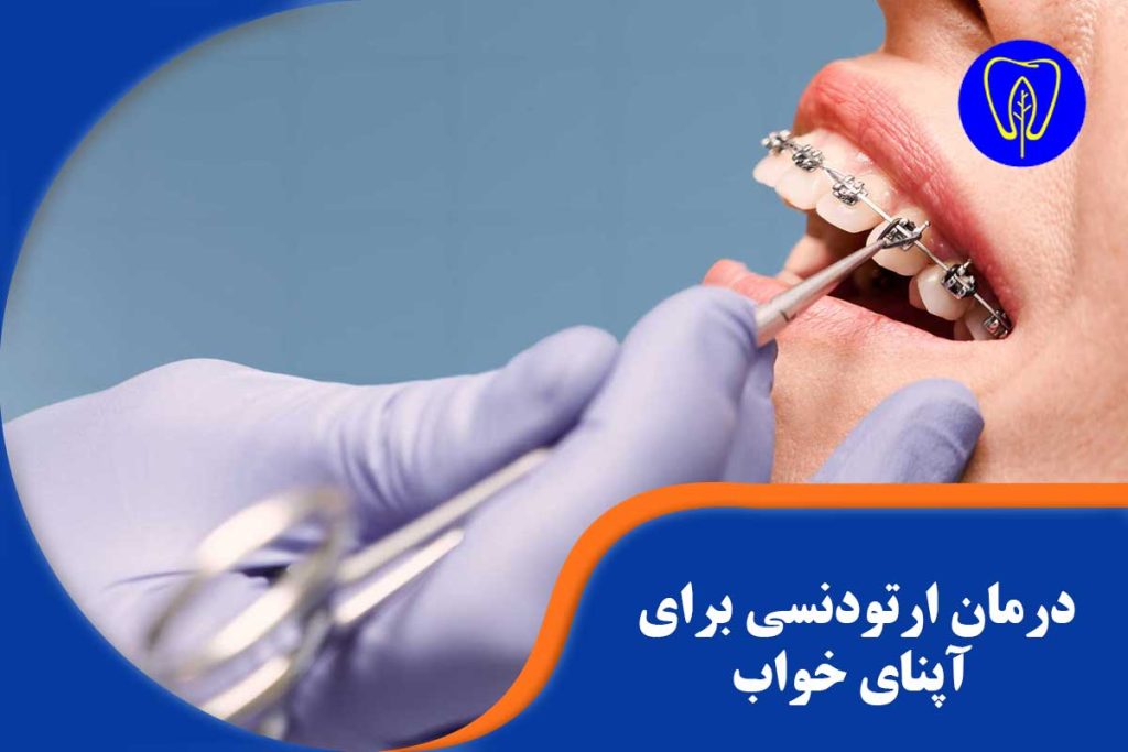 درمان ارتودنسی برای آپنای خواب