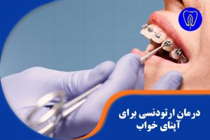 درمان ارتودنسی برای آپنای خواب