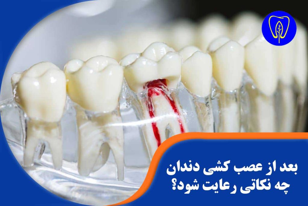 بعد از عصب کشی دندان چه نکاتی رعایت شود؟