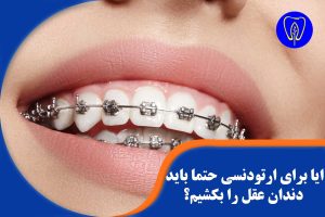 دندان عقل و ارتودنسی دندان