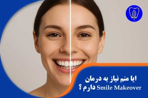 اصلاح لبخند