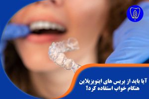 بریس های اینویزیلاین