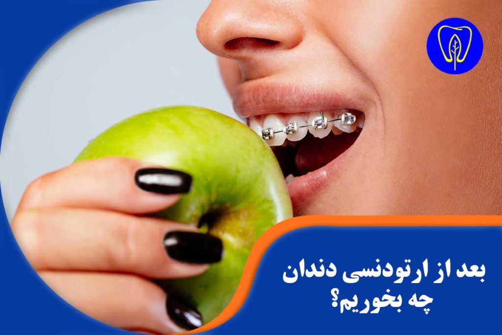 تغذیه بعد از ارتودنسی دندان