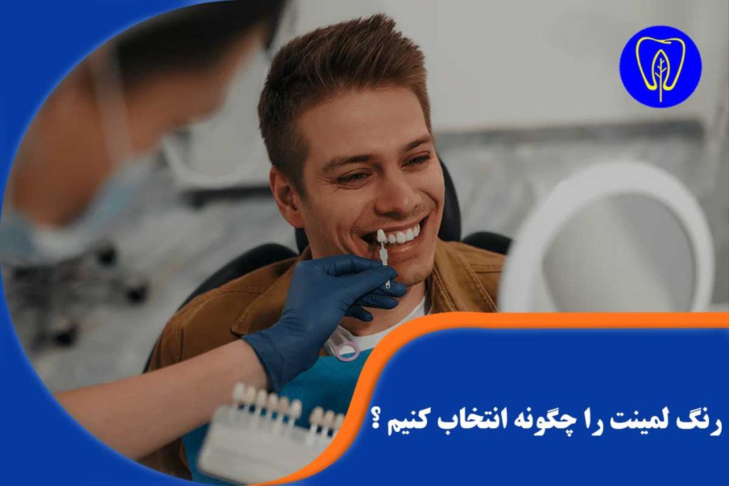 رنگ لمینت را چگونه انتخاب کنیم ؟