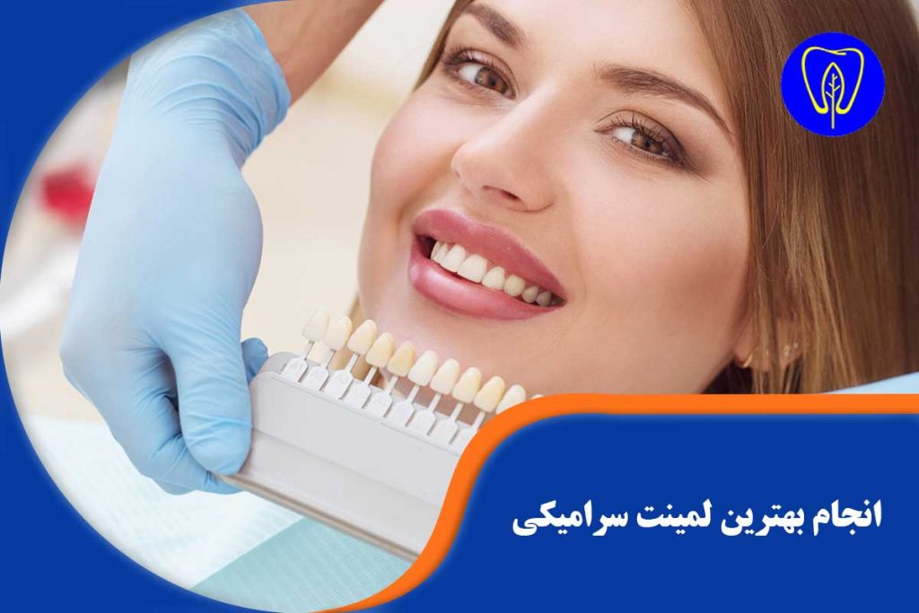 انجام بهترین لمینت سرامیکی