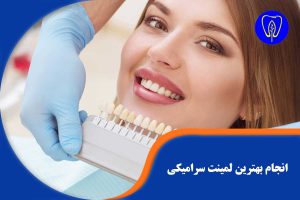 انجام بهترین لمینت سرامیکی