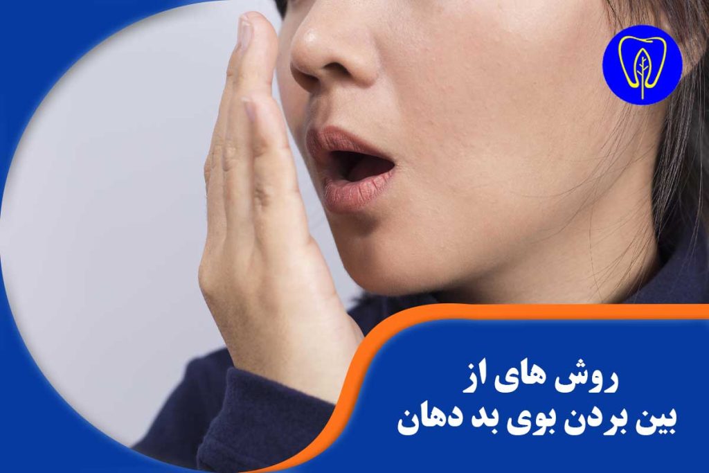 روشهای از بین بردن بوی بد دهان