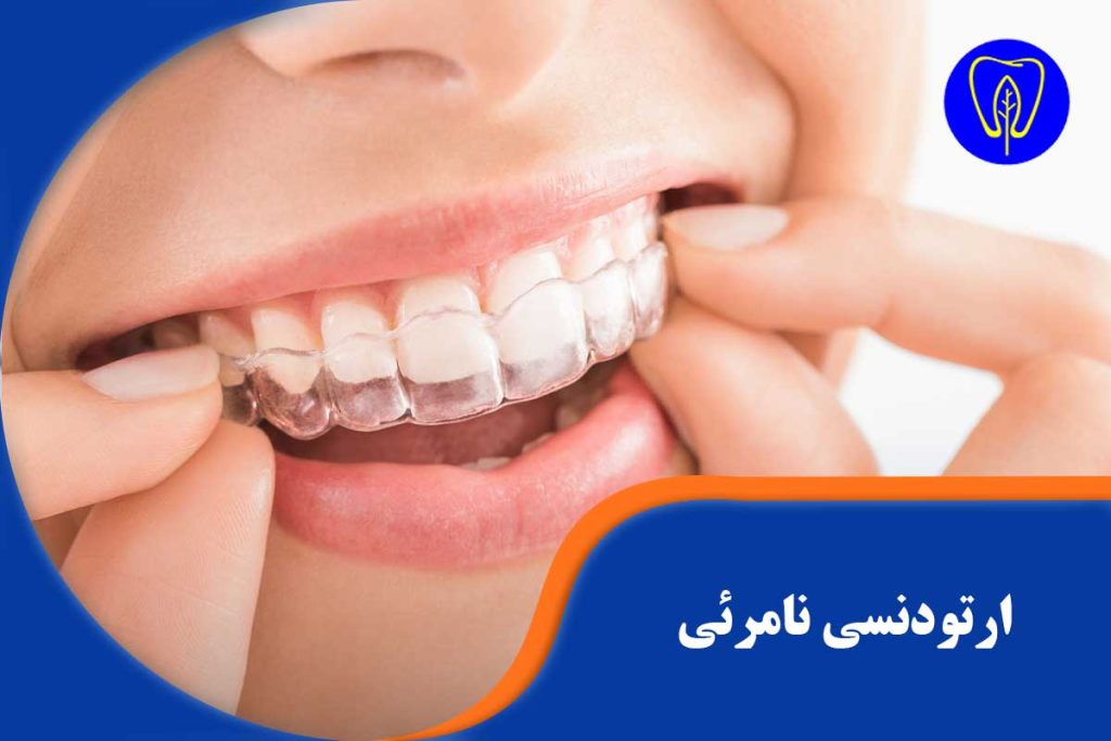 ارتودنسی نامرئی