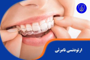 ارتودنسی نامرئی