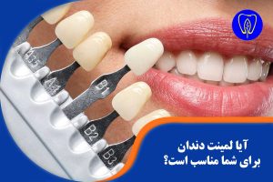 آیا لمینت دندان برای شما مناسب است؟