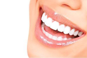 آیا لمینت دندان برای شما مناسب است؟