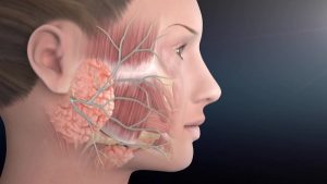 جراحی کیستها و تومورهای فک و صورت