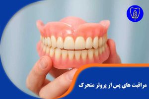 مراقبت های پس از پروتز متحرک