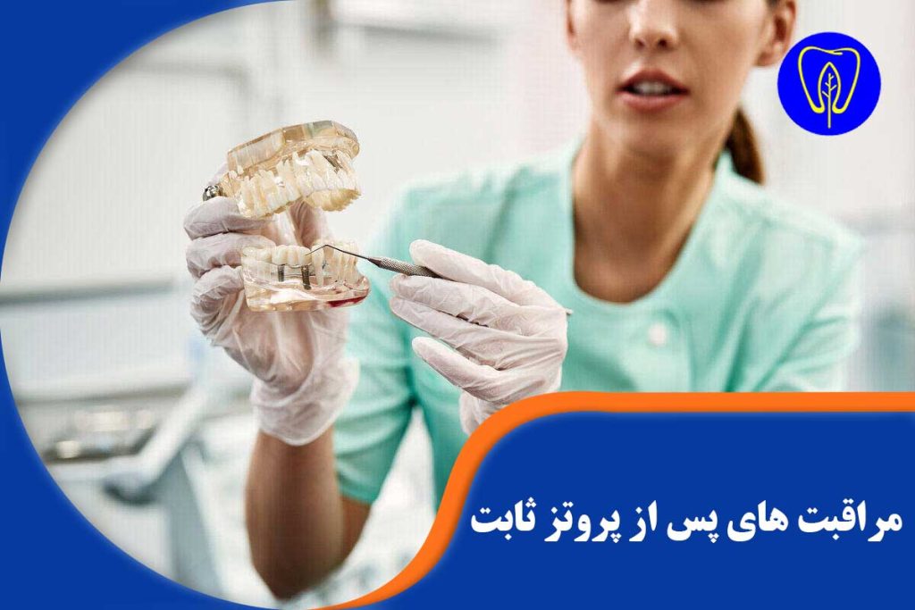 مراقبت های پس از پروتز ثابت دندان