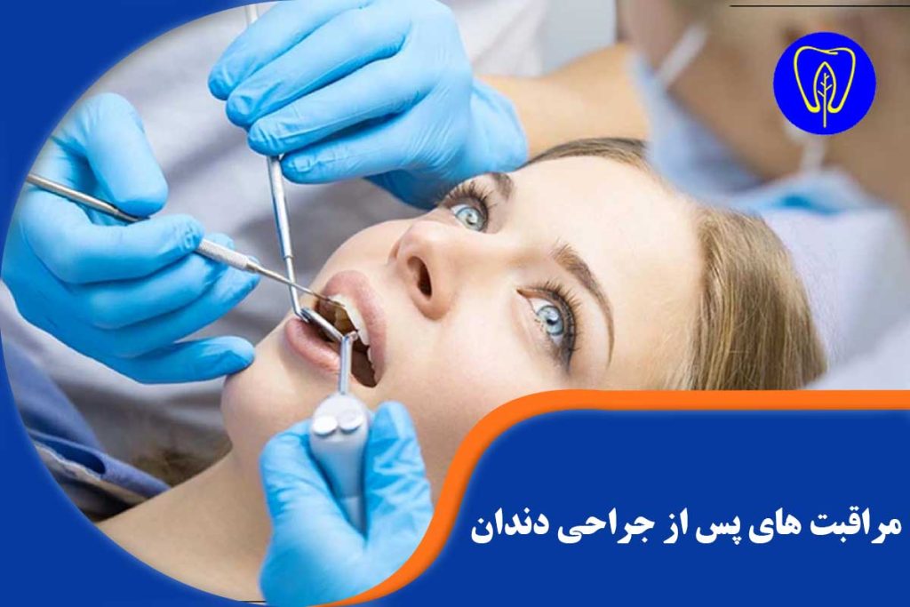 مراقبت های پس از جراحی دندان