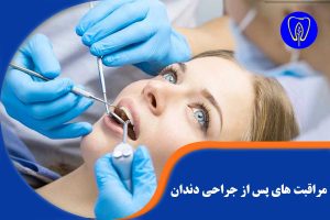 مراقبت های پس از جراحی دندان
